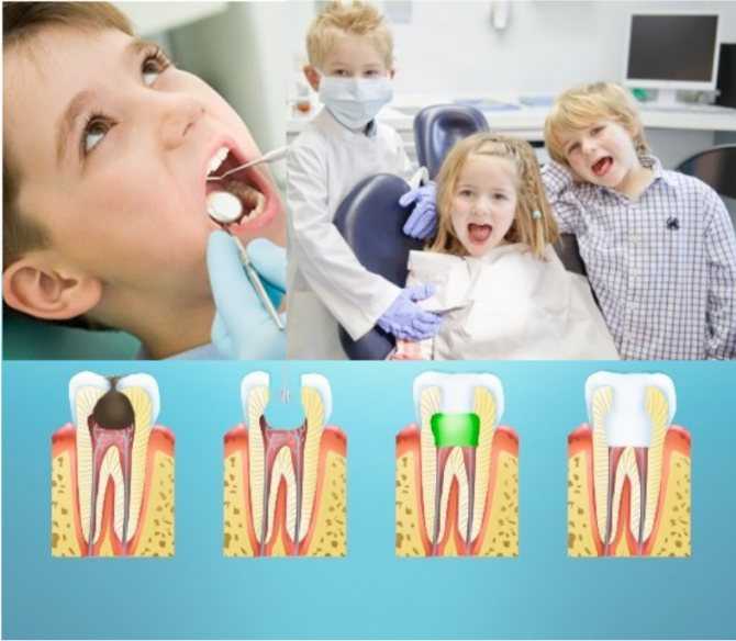 Нужно ли обезболивать молочные зубы во время лечения