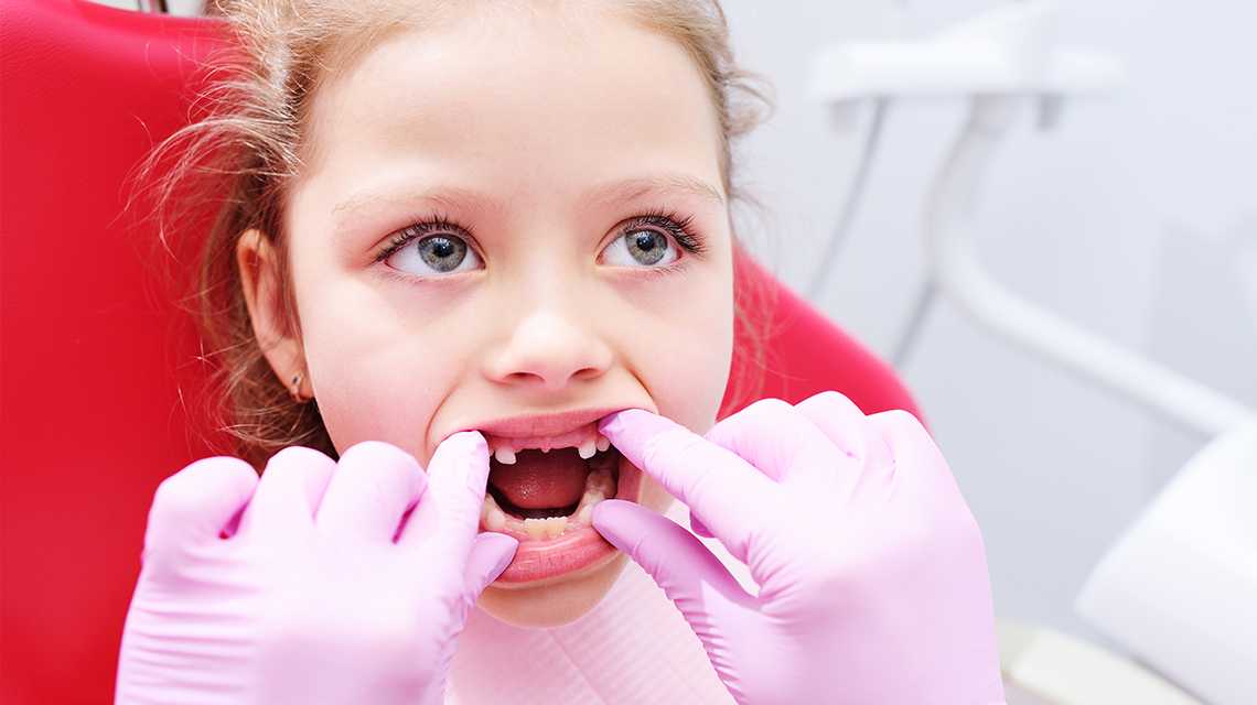 Кариес молочных зубов у детей: причины появления | гид по стоматологии