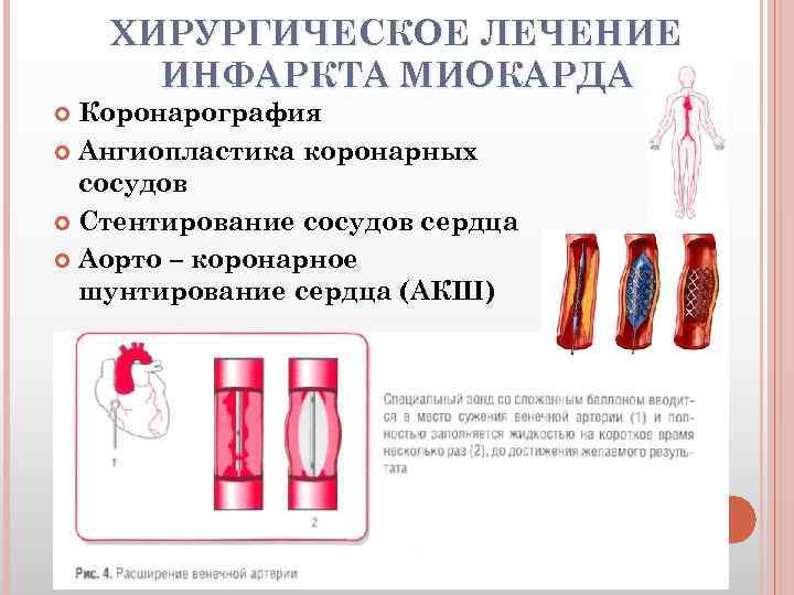 | поведенческие и эмоциональные нарушения у детей