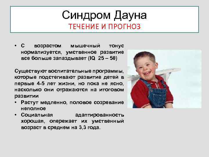 Обучение детей с синдромом дауна