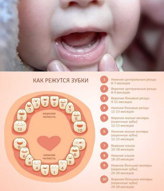 Детское протезирование или когда вашему ребенку требуется помощь ортодонта