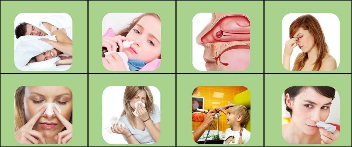 Заложенность носа насморка причины и лечение. При заложенности носа. Заложенность носа при рините.