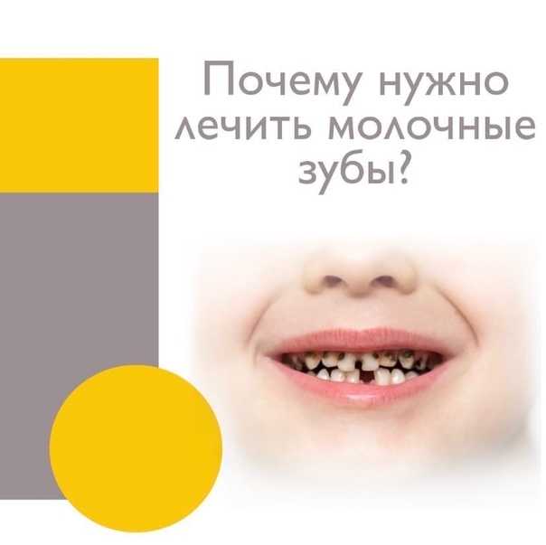 Социальная стоматология | памятка по уходу за молочными зубами. правила питания и гигиена полости рта
