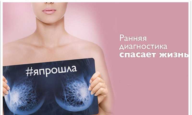 Профилактика рака молочной железы у женщин: препараты для профилактики рака молочной железы | клиники «евроонко»
