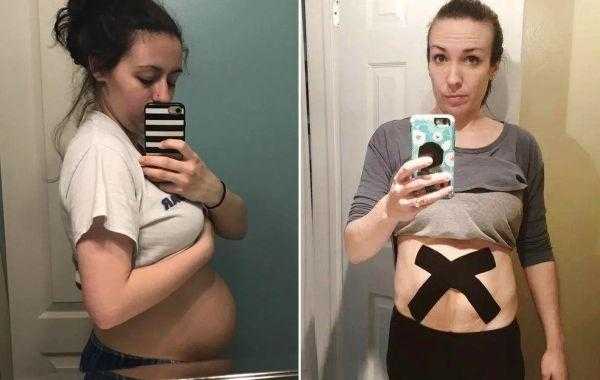 Фотосессия до и после рождения ребенка