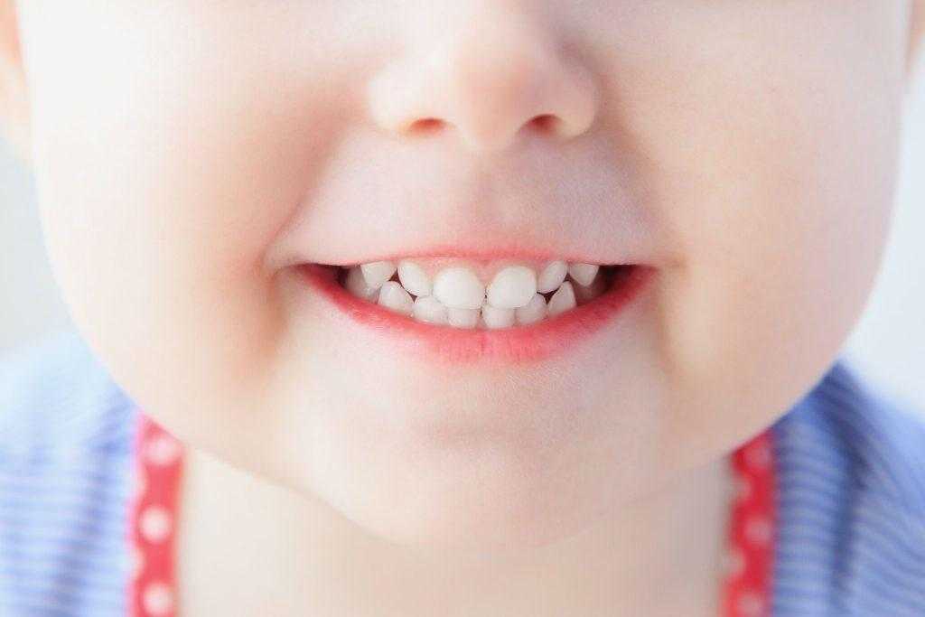 Кариес зубов: причины, симптомы, виды кариеса и профилактика | чем опасен кариес