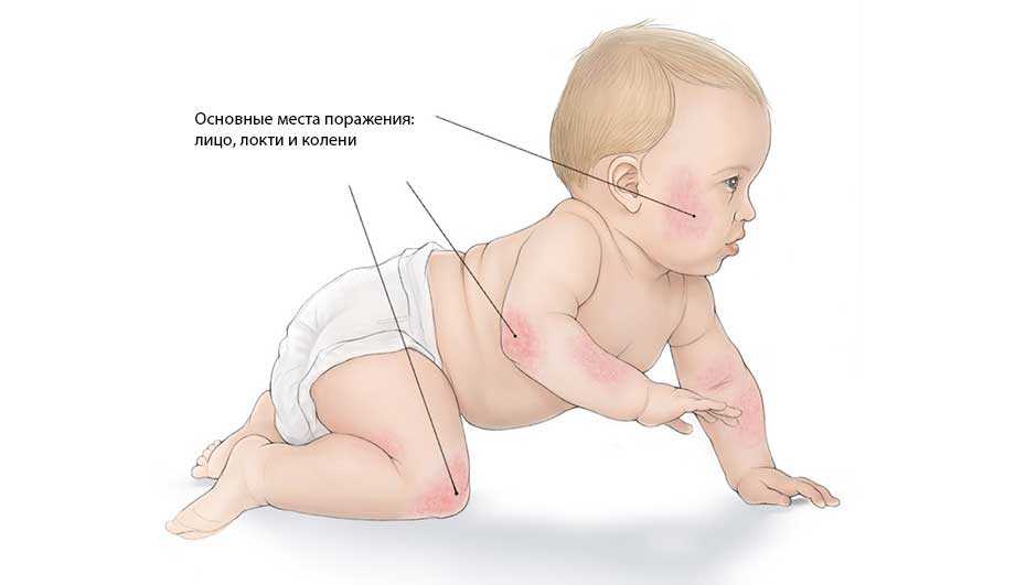 Уход за новорожденным ребенком: советы педиатров моц fortis