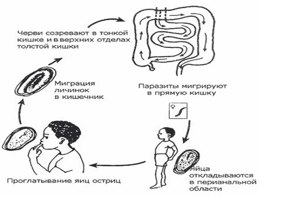 Энтеробиоз – инвазия острицами. причины, симптомы, диагностика и лечение энтеробиоза