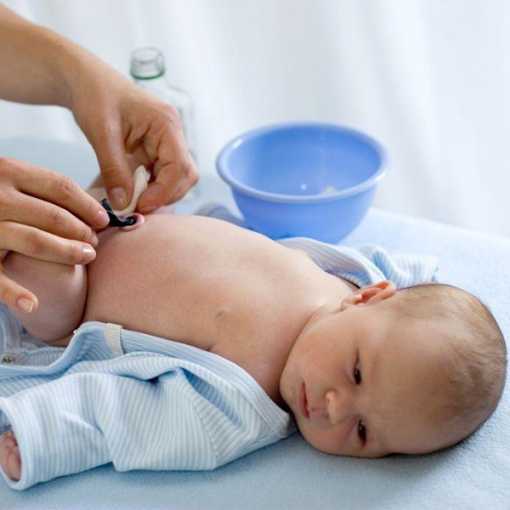 Как обрабатывать пупок новорожденного? почему кровит пупок младенца и как его обрабатывать? :: syl.ru