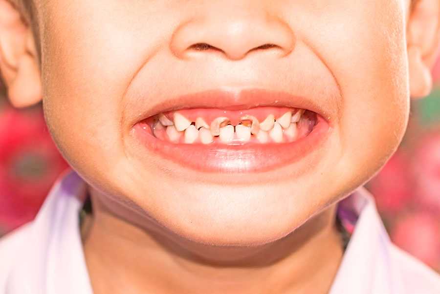 Жизненный цикл наших зубов: полезные советы, как уберечь зубы смолоду