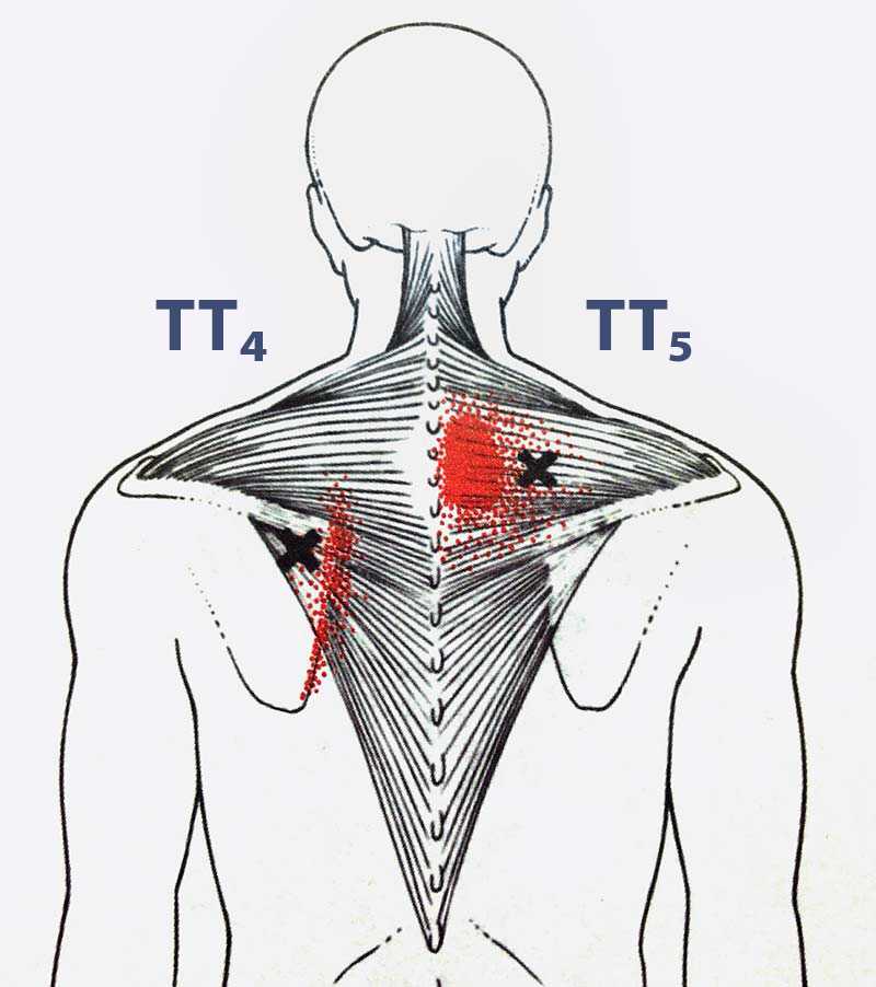 Комплекс упражнений лфк при грудном остеохондрозе. зарядка, лечебная физкультура