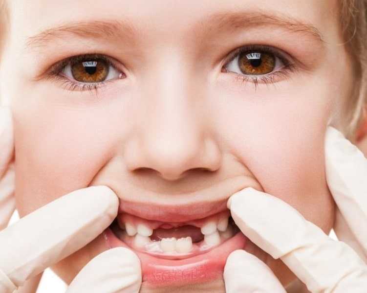 Полезные советы по уходу за зубами ребенка