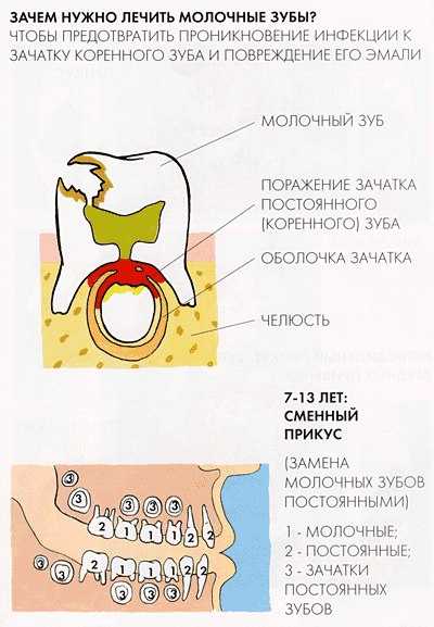 Статья - 5 причин вылечить молочные зубы
