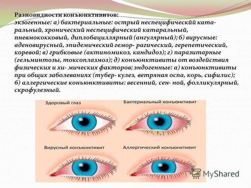Зрение у детей до года особенности | нормы зрения у детей до года | эксимер