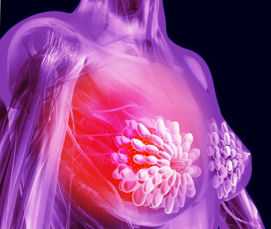 Рак груди кормящей мамы – причины и лечение
