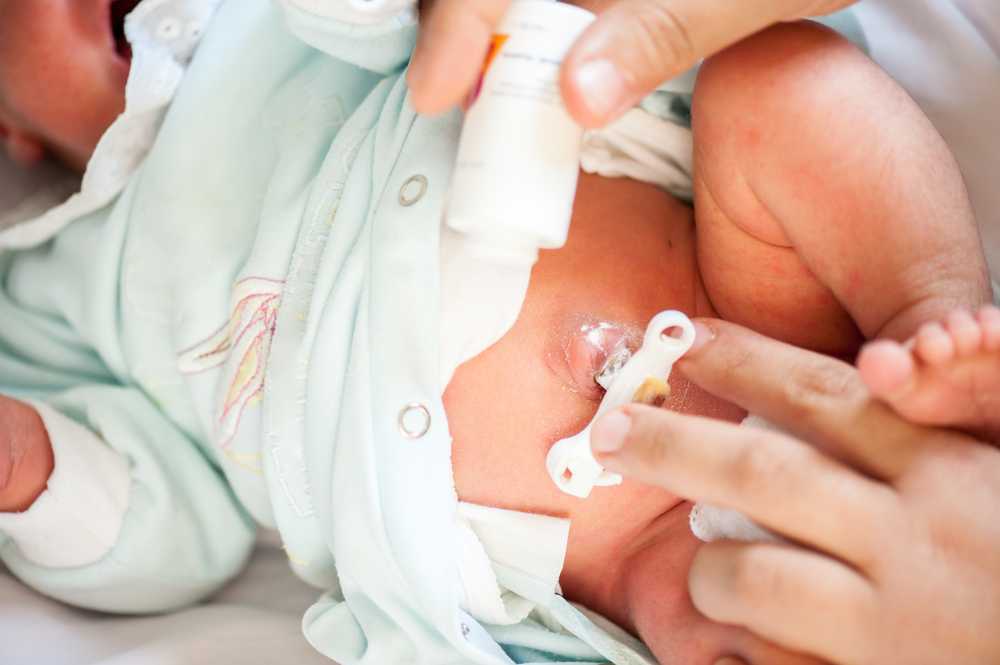 Кровит пупок у новорожденного | уроки для мам