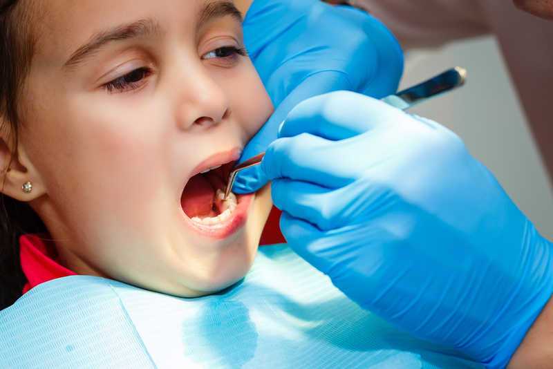 Кариес: причины появления, лечение, профилактика – стоматология президент
