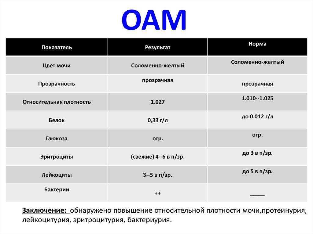 Анализ мочи в норме образец