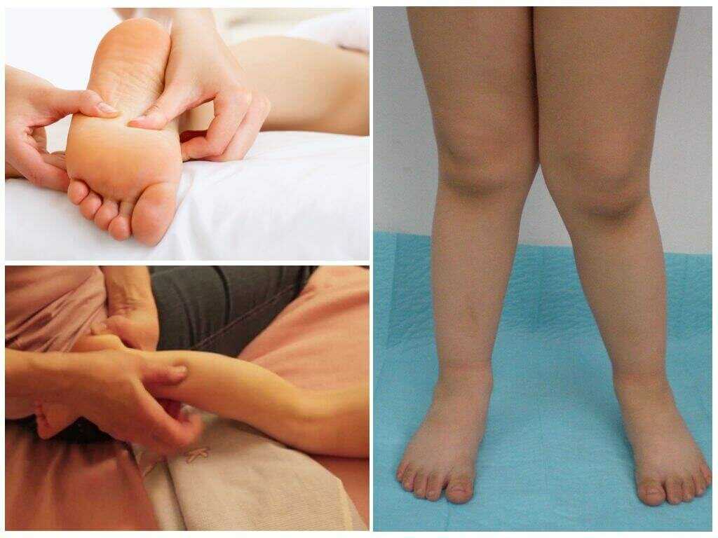 Детский массаж для укрепления ног - юлия рязанова