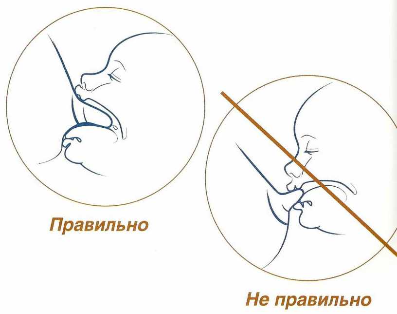Кормление грудью: как победить лактостаз, трещины и др. проблемы • центр гинекологии в санкт-петербурге