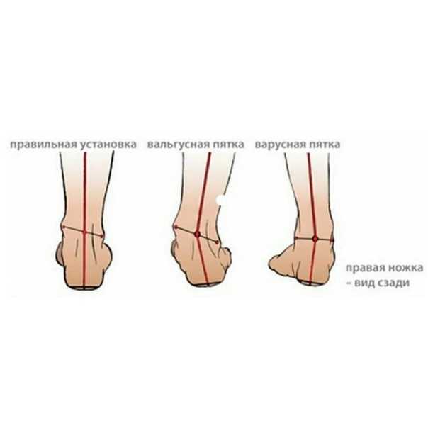 Синдром беспокойных ног ️: симптомы, признаки и причины, диагностика и лечение