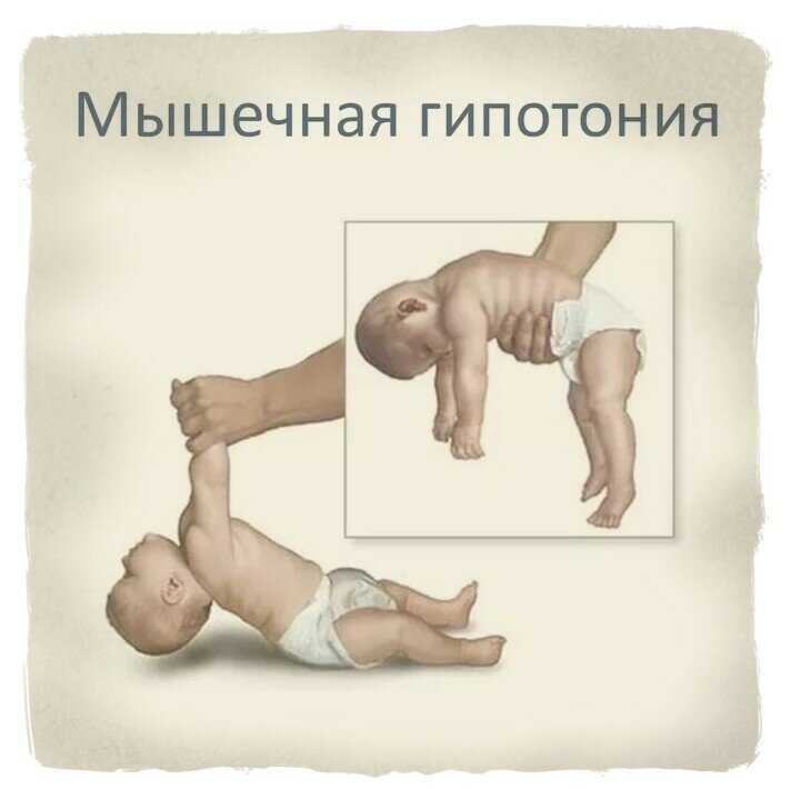 Развитие мелкой моторики рук у детей | крупная моторика: развивающие занятия для малышей, упражнения