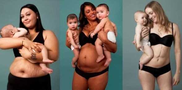 Женщины показали, как на самом деле выглядит тело после родов: 14 фото
