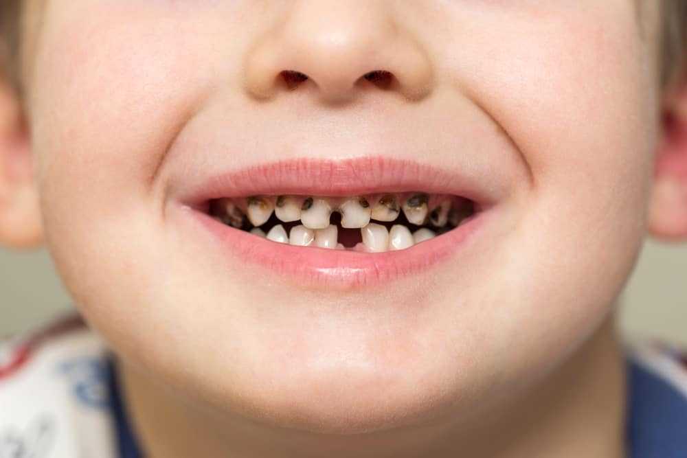 7 правил ухода за зубами в домашних условиях