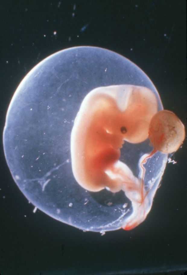 6 (шестая) акушерская неделя беременности: что происходит с малышом и мамой, развитие плода, ощущения женщины, фото узи