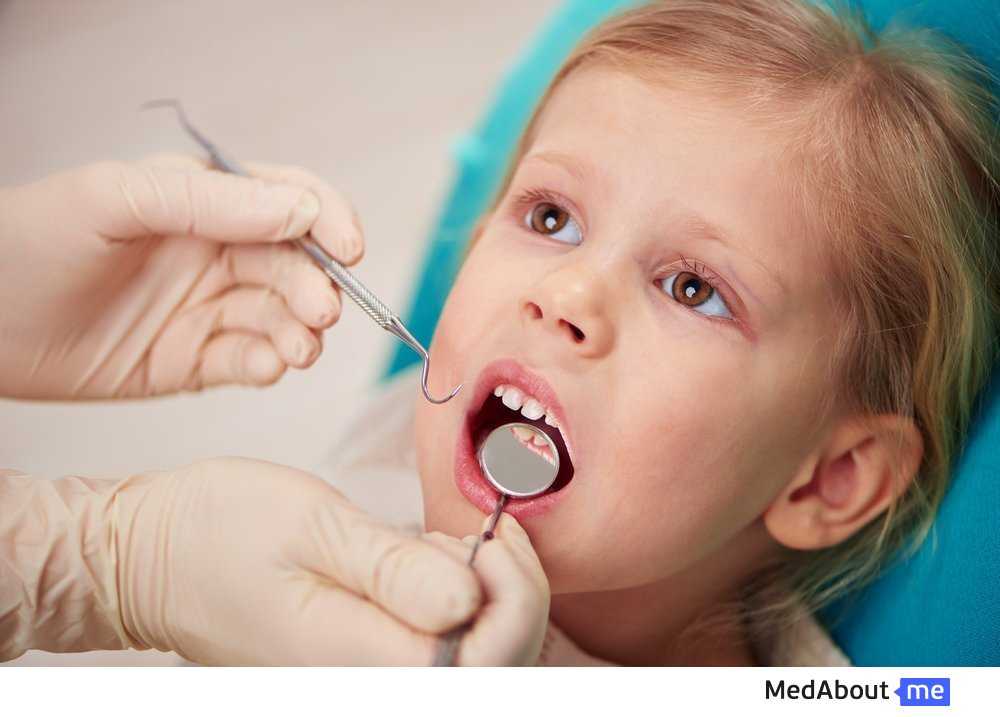 Кариес молочных и постоянных зубов у детей