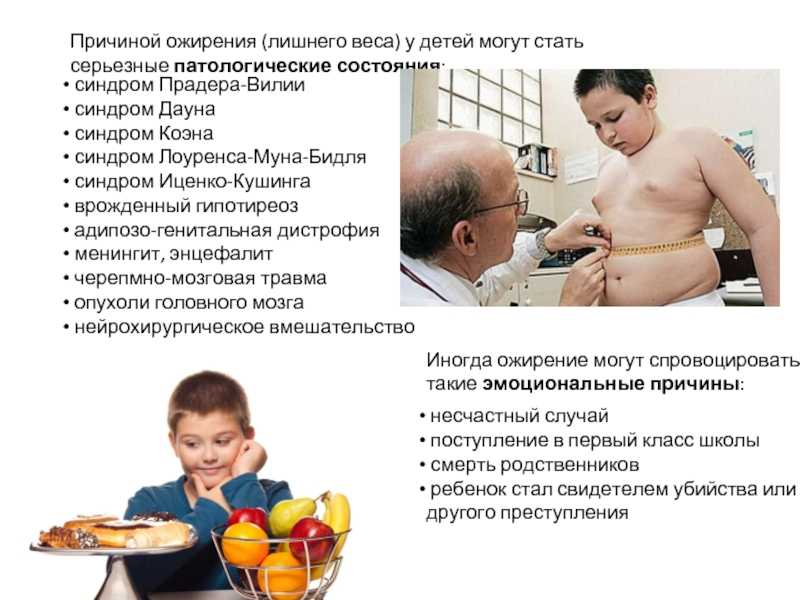 Причины и типы детского ожирения