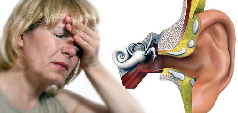 Снижение слуха и нарушение мозгового кровообращения. факты и рекомендации