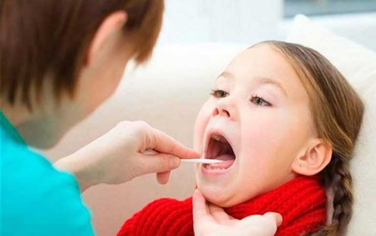 Острый и хронический тонзиллит у детей
