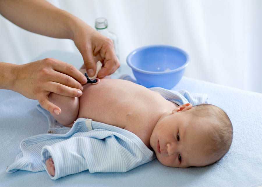 Омфалит у новорожденных: причины и виды заболевания, клинические проявления, диагностика, возможные осложнения