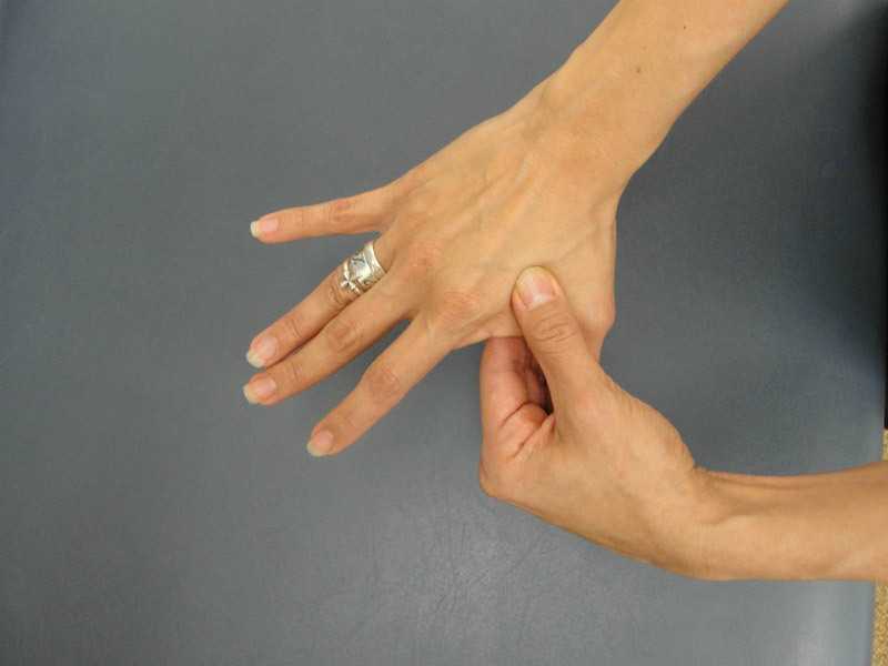Артрит пальцев рук - симптомы и лечение воспаления суставов