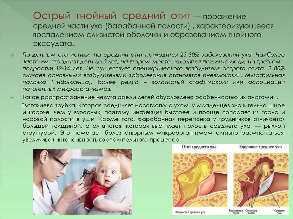 Отит уха у ребенка - симптомы и лечение отита 2019.