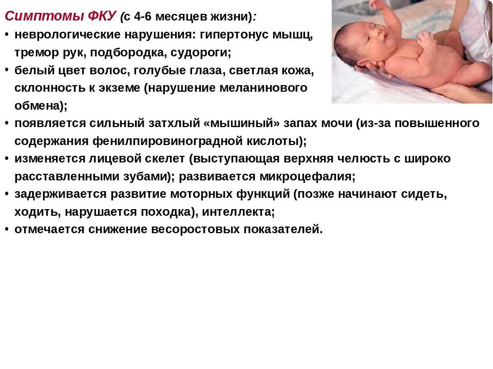 Тремор у новорожденных: причины, последствия комаровский