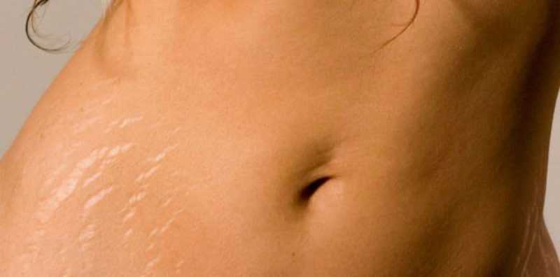 Уход за грудью: как женщине сохранить красивую форму бюста