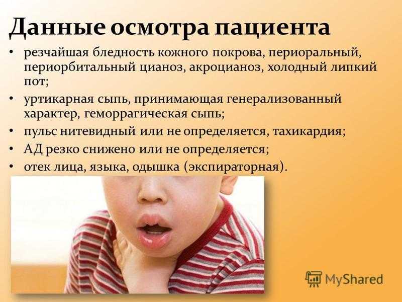 Аллергическая сыпь у детей
