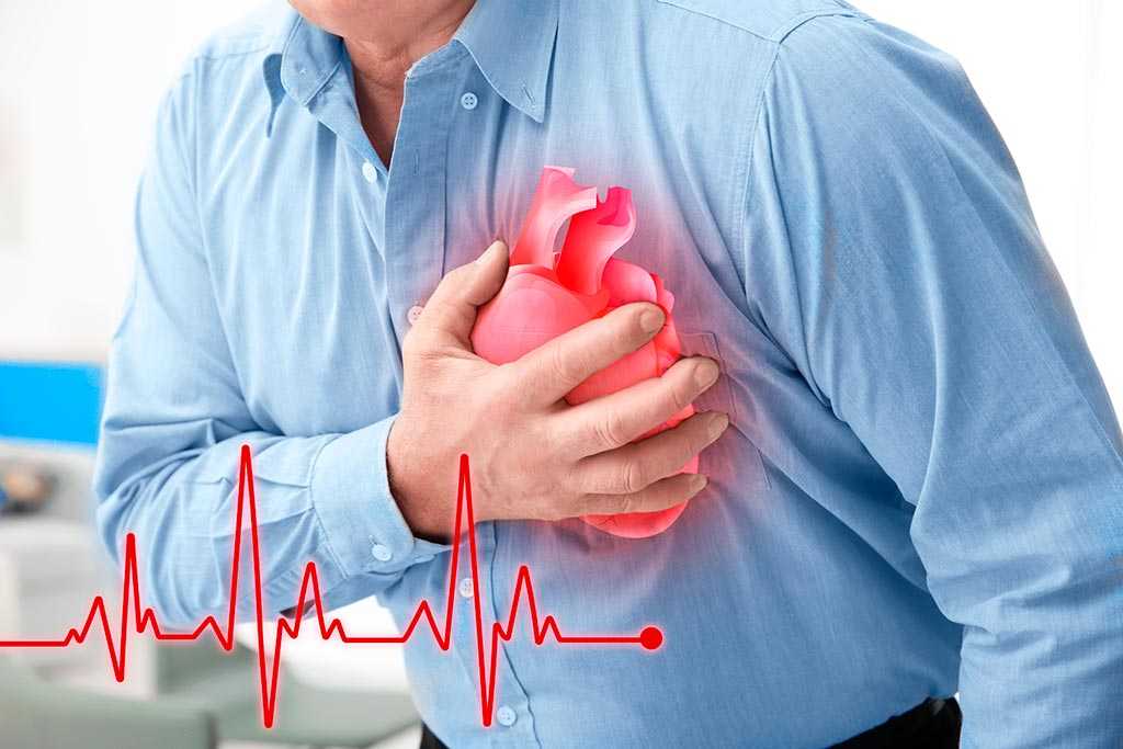 Диета №10 – при заболеваниях сердечно-сосудистой системы