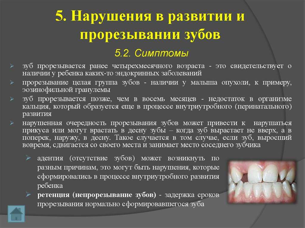 Прорезывание зубов у грудничков - как режутся зубы в грудном возрасте - симптомы и схема прорезывания
